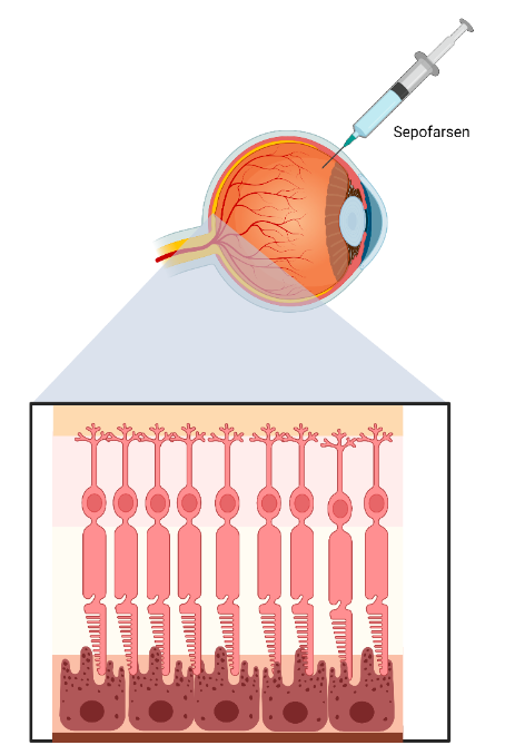 eye gene therapy